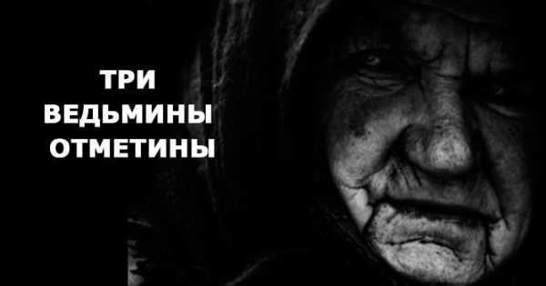 Что значат родинки на Вашем теле