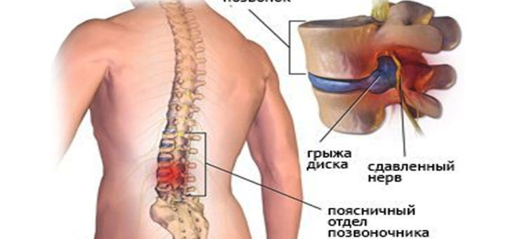 Этот простой секрет избавит от боли в спине, ногах, коленях и ступнях всего за 5 минут!