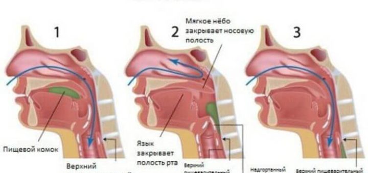 Если что-то застряло в горле — воспользуйтесь приемом Геймлиха. Особенно, если в доме дети! Это важно знать и не сложно применить!