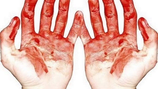 К чему снится кровь по сонникам психоаналитиков Лоффа, Фрейда