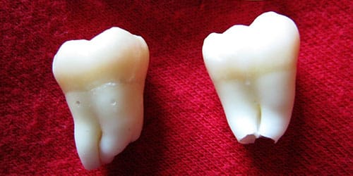 К чему снятся зубы по известным сонникам Фрейда, Миллера, Ванги