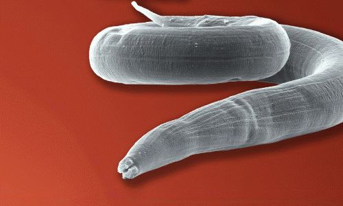 К чему снятся живые глисты у себя?