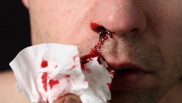 К чему снится кровотечение по сонникам Адаскиной, Зэдкиеля