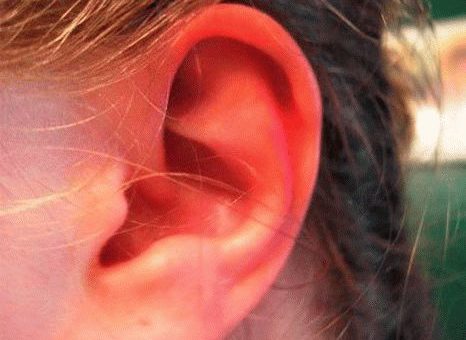Примета: к чему горят уши?