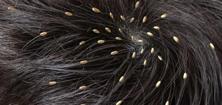 К чему снятся гниды и как понять значение гнид во сне