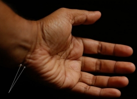 Линии на запястье - браслеты или рассцеты. Значение браслетов на запястье