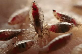 К чему снятся вши в голове?