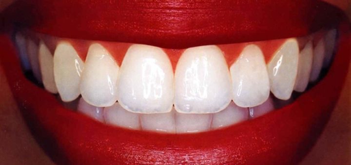 К чему снятся зубы по сонникам и основным значениям