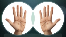 Разрыв на линии жизни