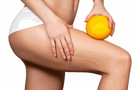 Целлюлит: причины возникновения