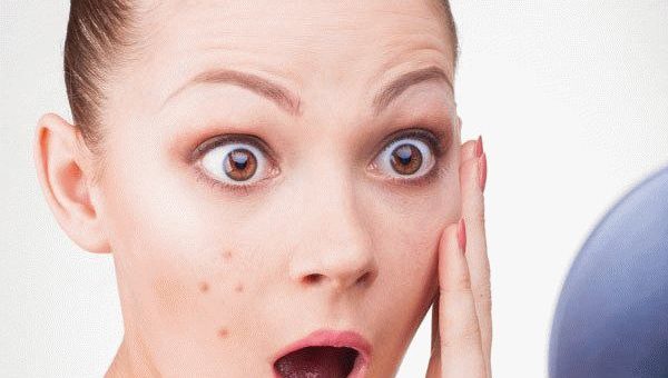 К чему снятся прыщи на лице - предсказания