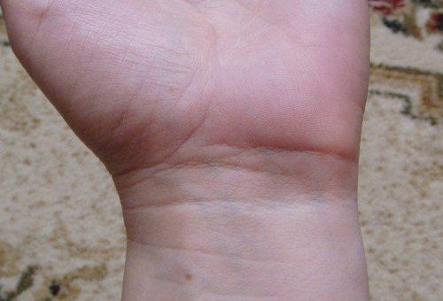 Браслеты на запястье в хиромантии: описание и значение