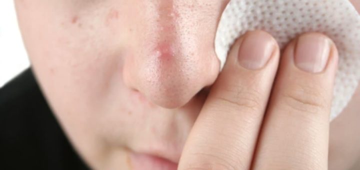 Народные приметы про прыщи на попе, на спине, на носу