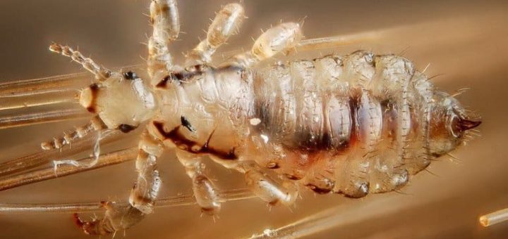 К чему снятся вши - сонник