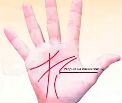 Разрыв на линии жизни – что обозначает