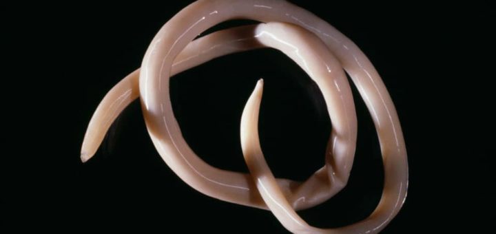 К чему снятся глисты - толкование по сонникам