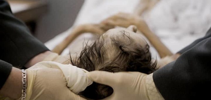 К чему снятся трупы - толкование по сонникам