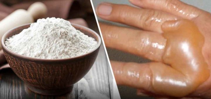 8 домашних средств для быстрого лечения ожогов